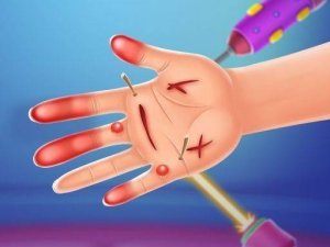 Hand Doctor Online Game Simulation