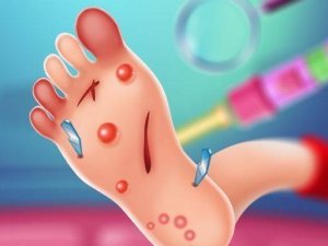 Foot Doctor Online Game Medical Game