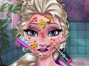 Ice Queen Skin Doctor - Online Treatment Game